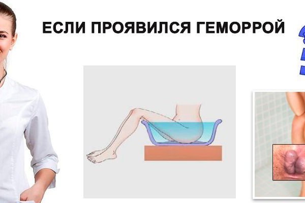 Кракен маркет даркнет только через тор скачать